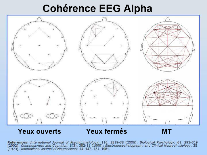 Cohérence EEG pendant la MT